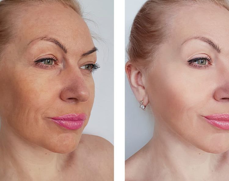 Lumi Beauty – Masseur Facial LED 7-en-1