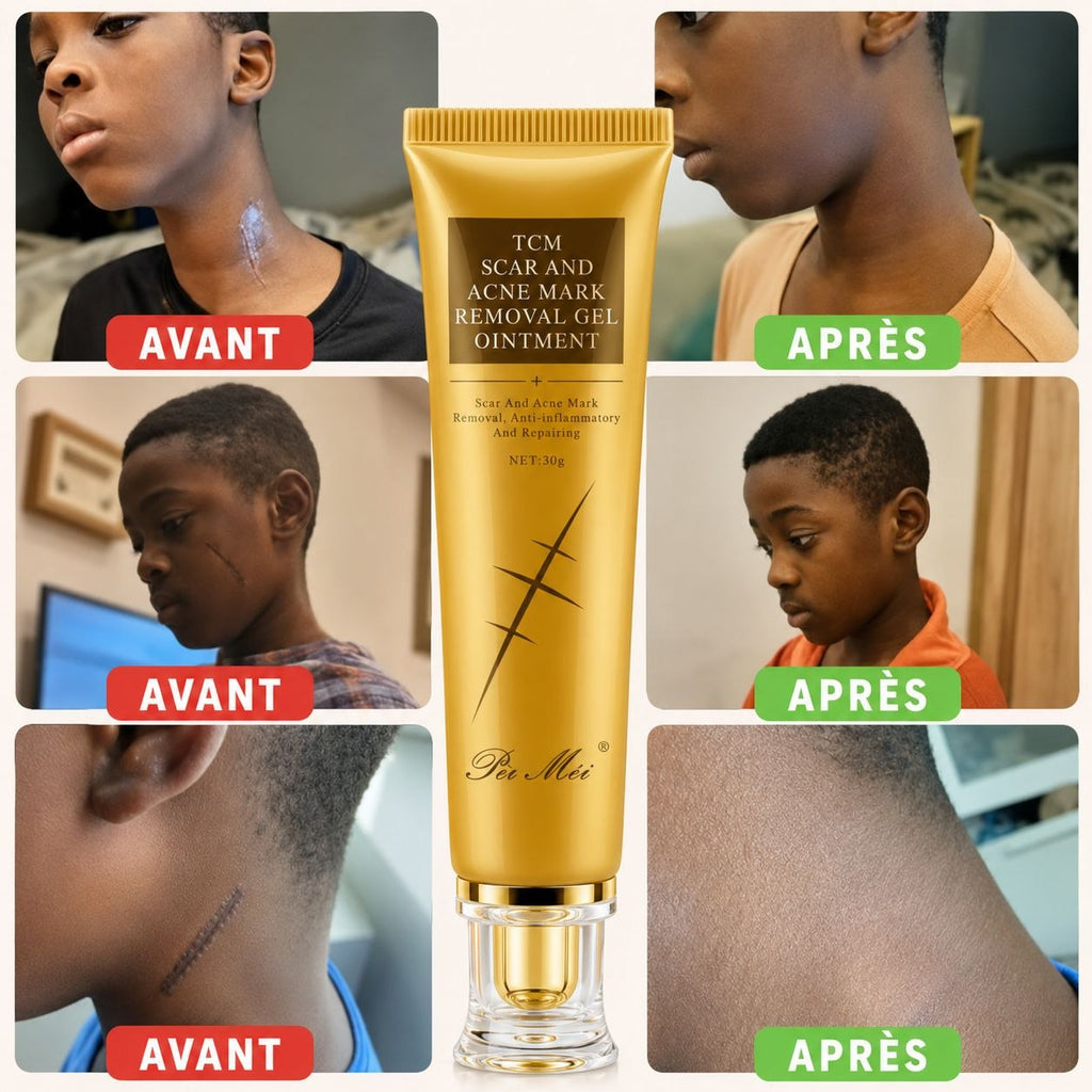 Crème pour vergeture et cicatrice