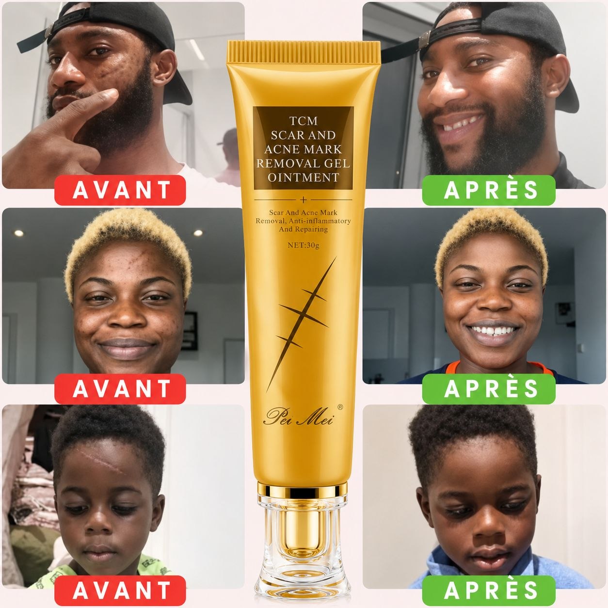 Crème pour vergeture et cicatrice