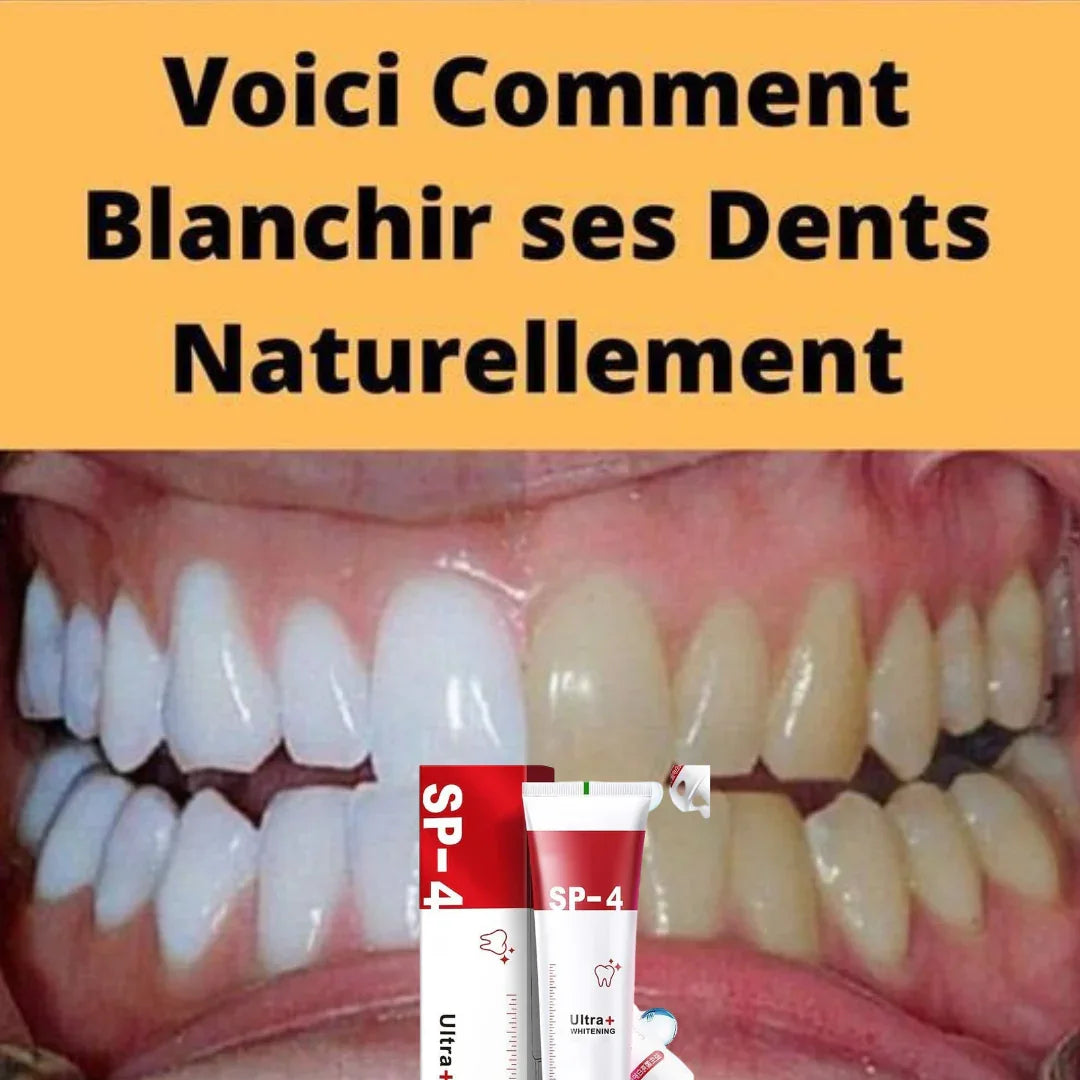 SP4 Dentifrice blanchissant probiotique Gestion de la santé bucco-dentaire(Élimine des années de taches) gab